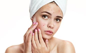 Acne Relief Facial