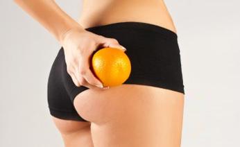 Anti-Cellulite Cupping Treatment